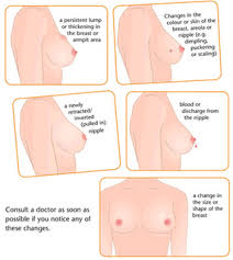 gejala kanker payudara secara herbal