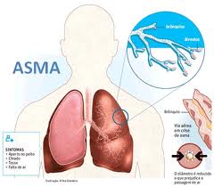 Penyakit Asma Herbal
